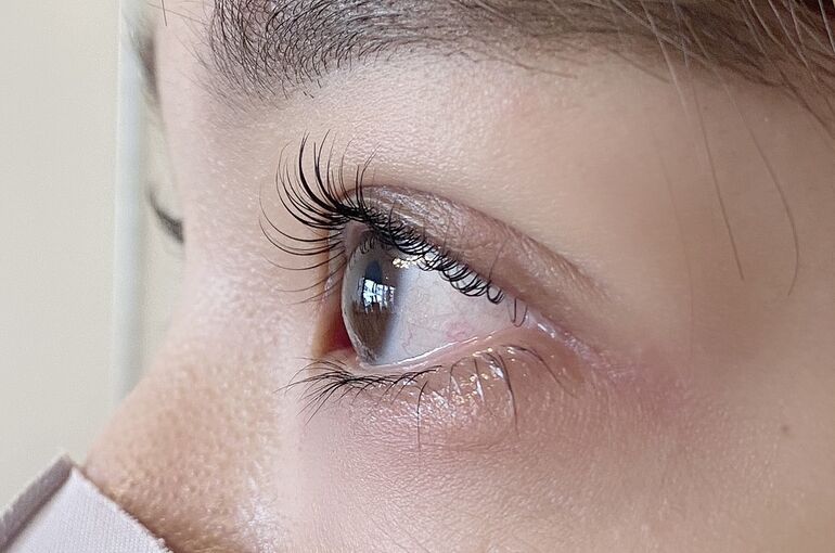 0358DA2E-94E4-428A-8686-5639FA8EBE9A_1_201_a